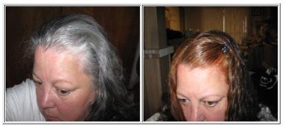 Home Remedies For Grey Hair How To Stop Premature Greying Of Hair And  Prevent Naturally